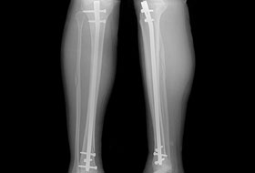 X-Ray