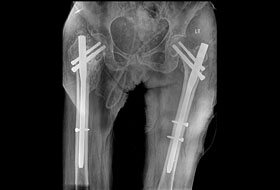 X-Ray