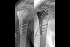 X-Ray