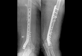 X-Ray